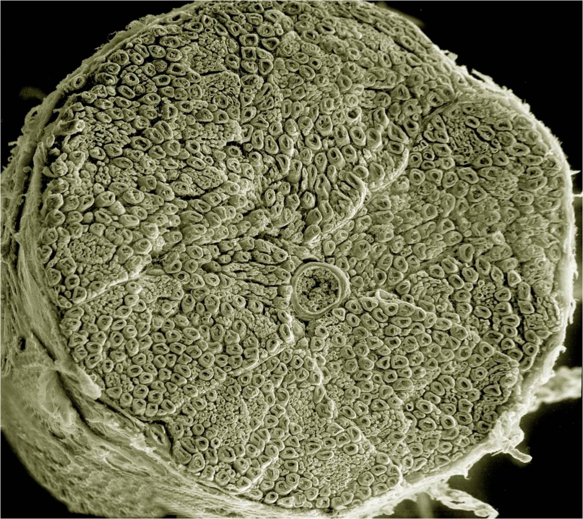 Intramuscular InjectionsCome With Far More Risks Than Benefits